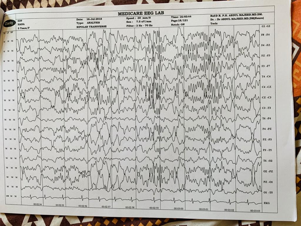 Patient Story